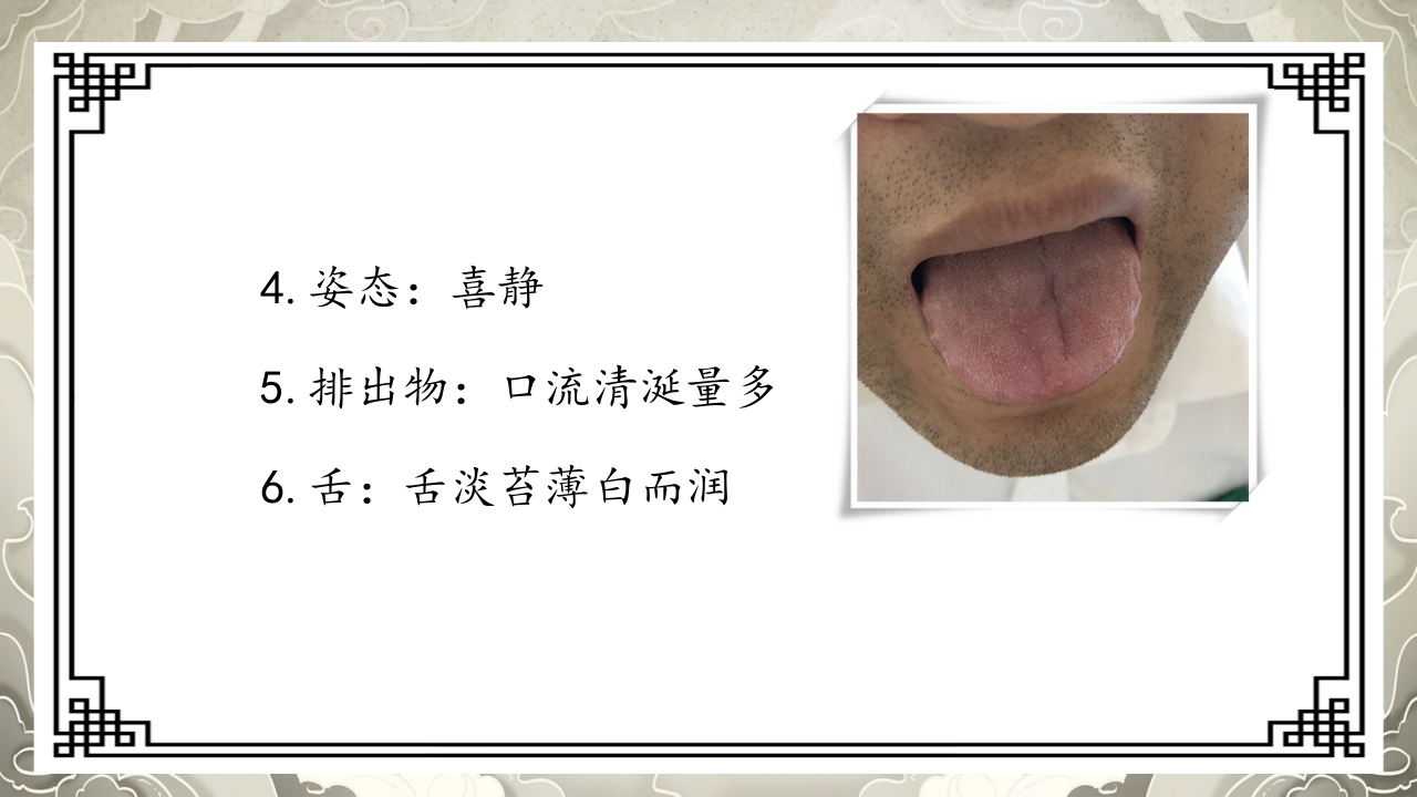 胃脘痛护理案例分析PPT课件13