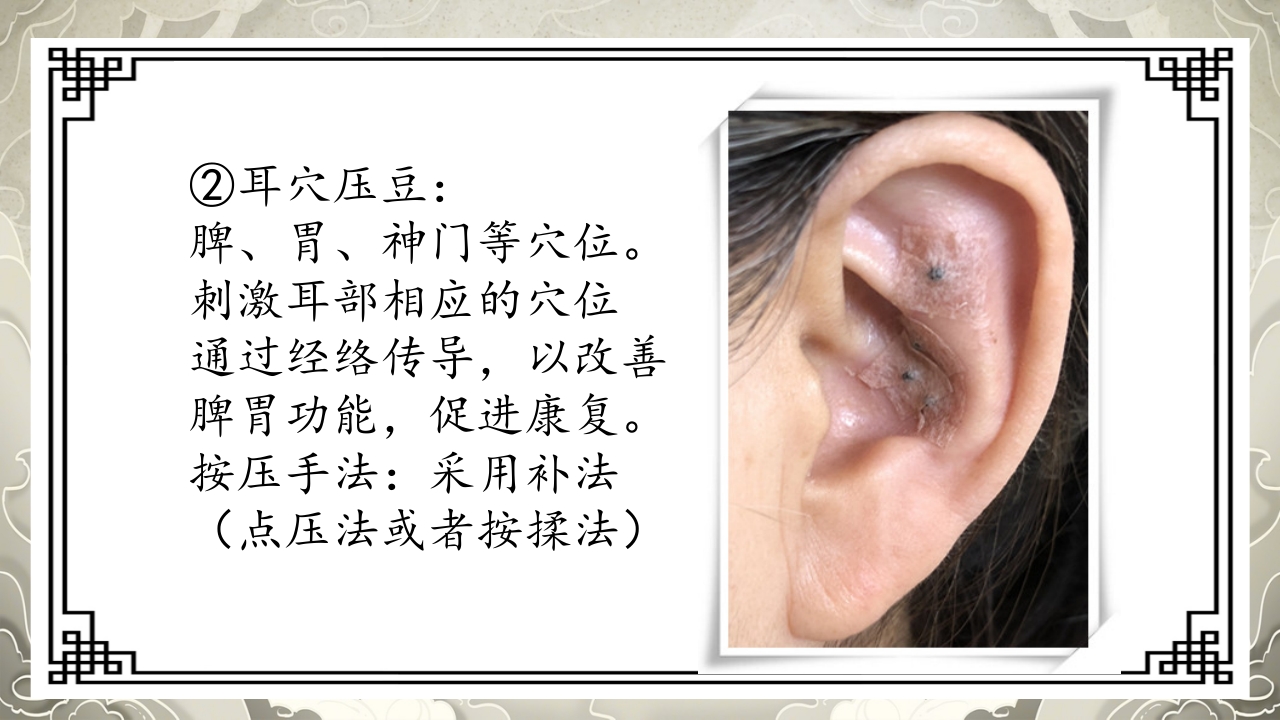 胃脘痛护理案例分析PPT课件22