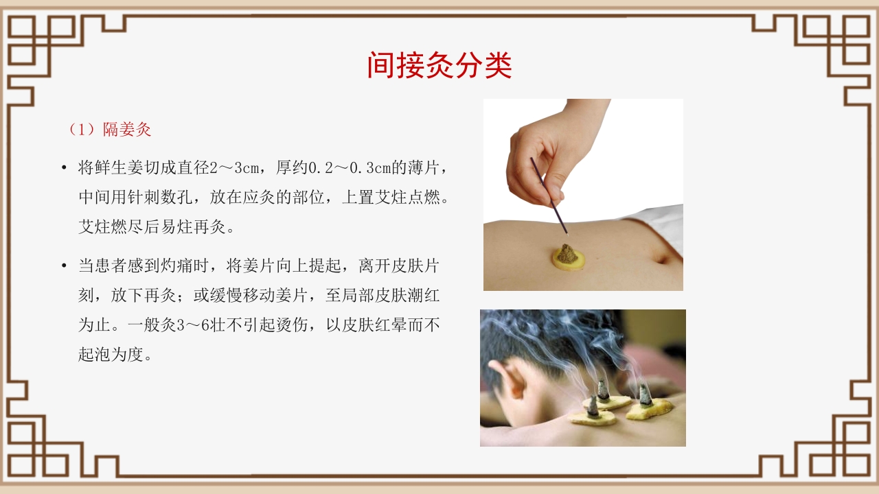 中医艾灸疗法PPT课件22