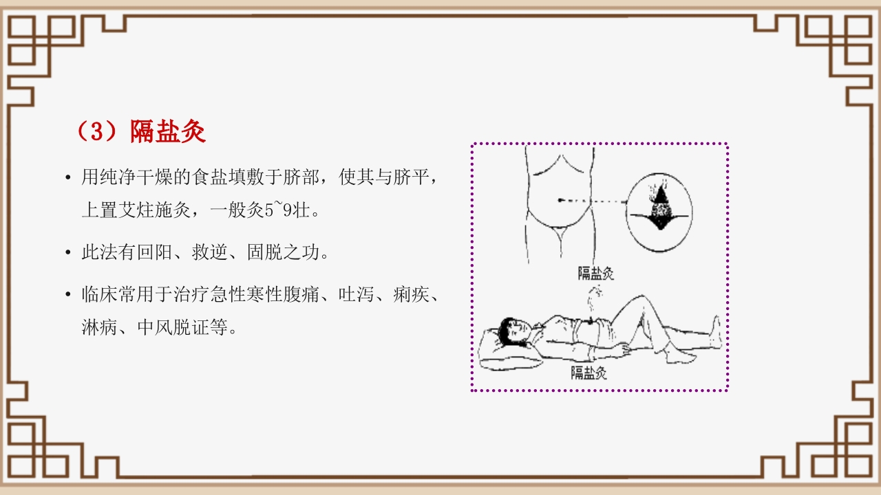 中医艾灸疗法PPT课件29