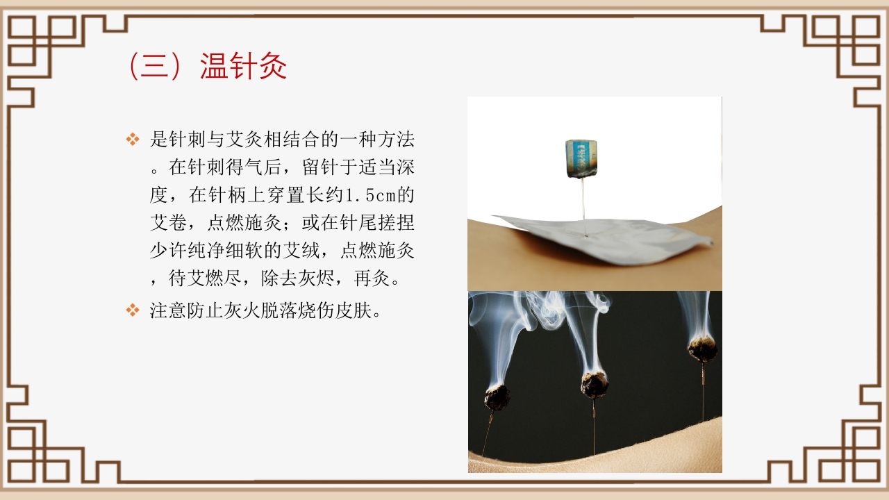 中医艾灸疗法PPT课件40