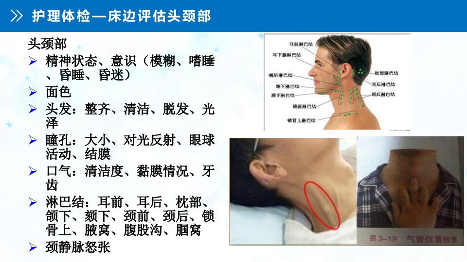 肺癌伴上腔静脉综合症ppt课件14