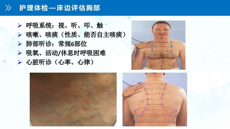 肺癌伴上腔静脉综合症ppt课件15