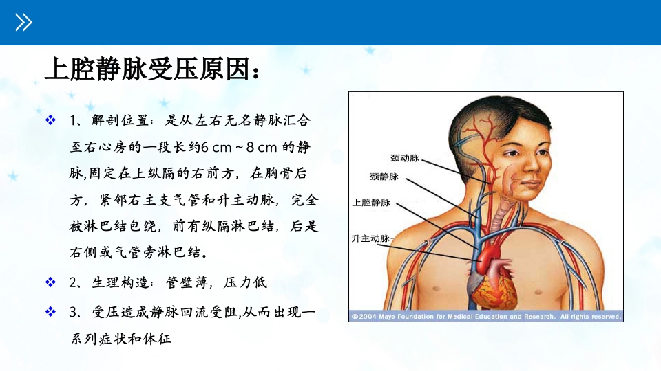 肺癌伴上腔静脉综合症ppt课件33