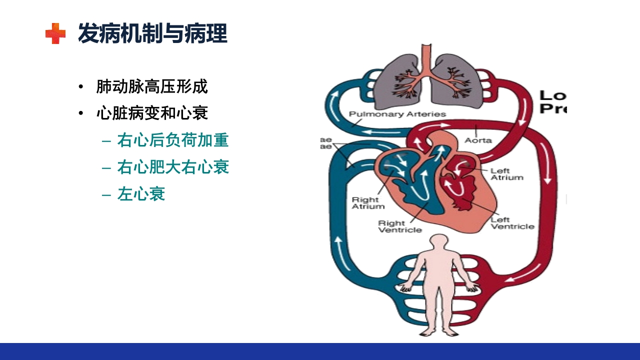 慢性肺源性心脏病PPT课件12