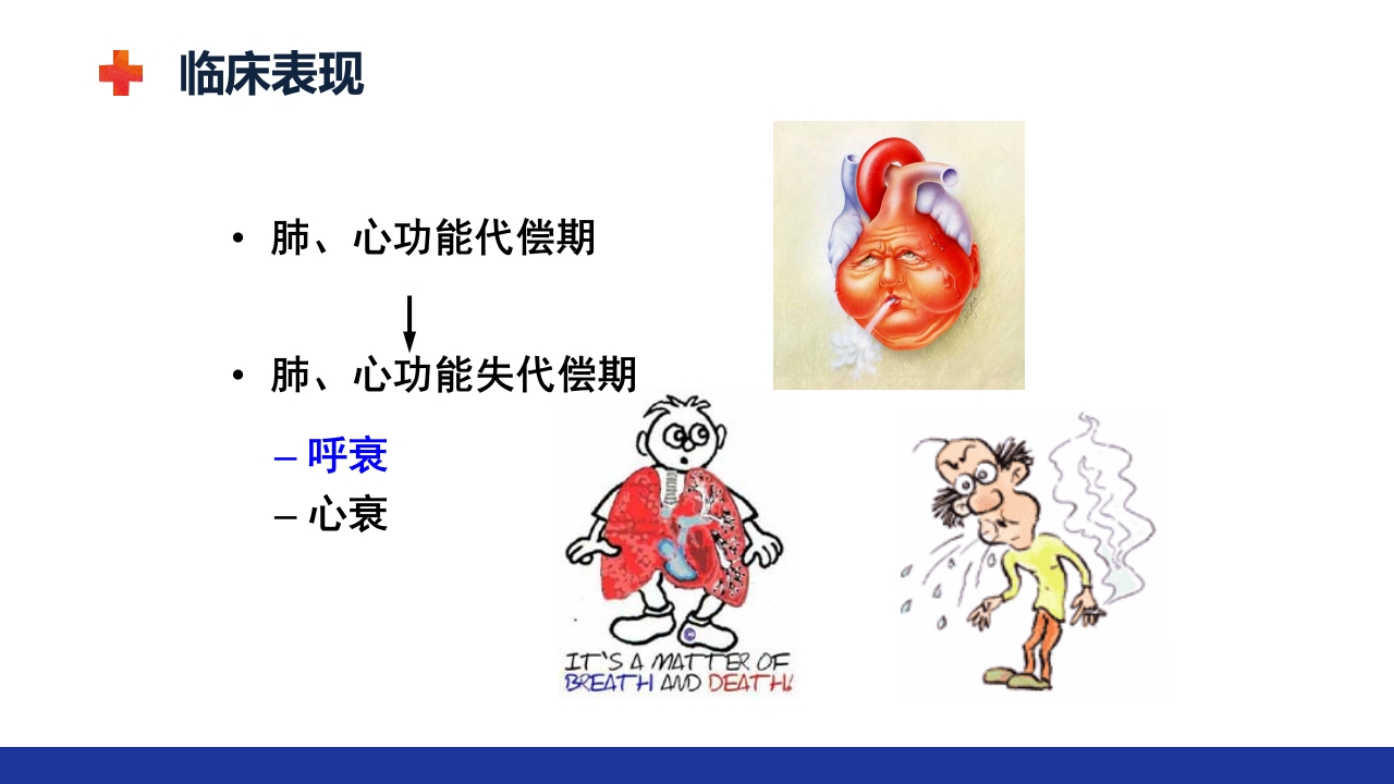 慢性肺源性心脏病PPT课件17