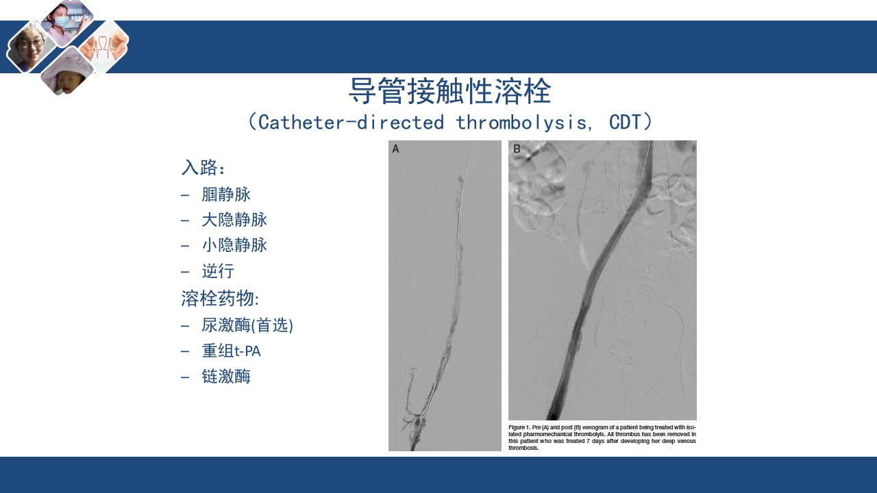 静脉血栓栓塞(VTE)诊断、治疗和预防ppt课件31
