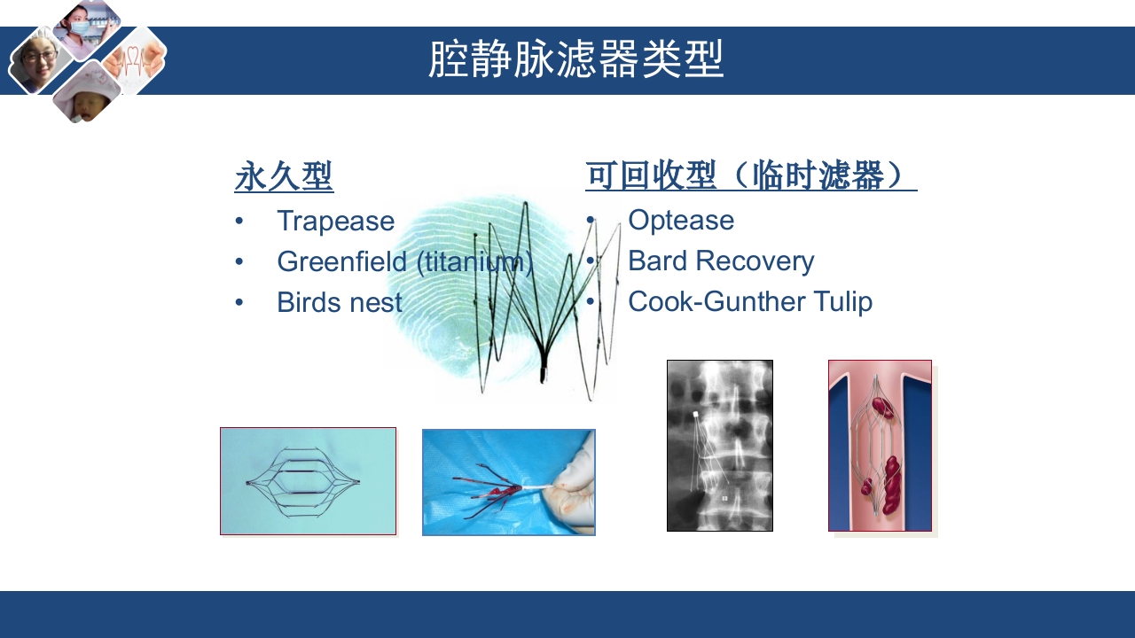 静脉血栓栓塞(VTE)诊断、治疗和预防ppt课件34
