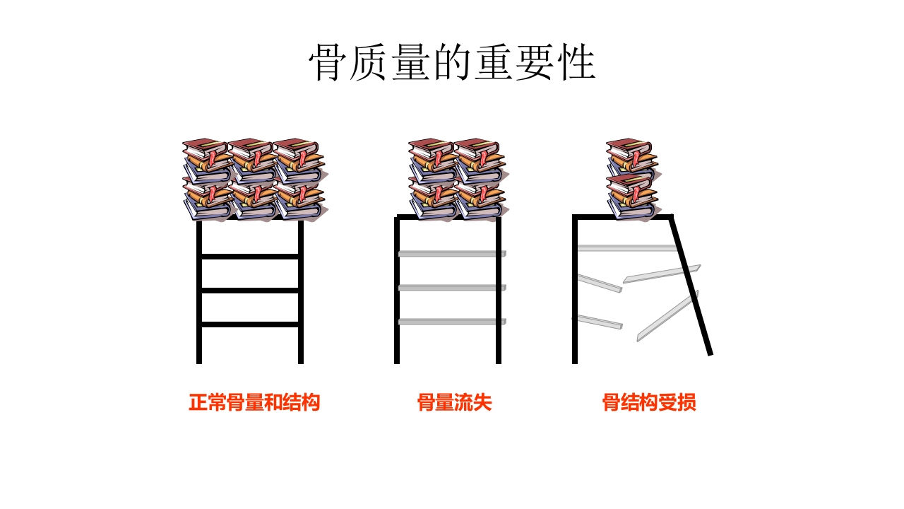 骨质疏松的诊断与治疗ppt课件14