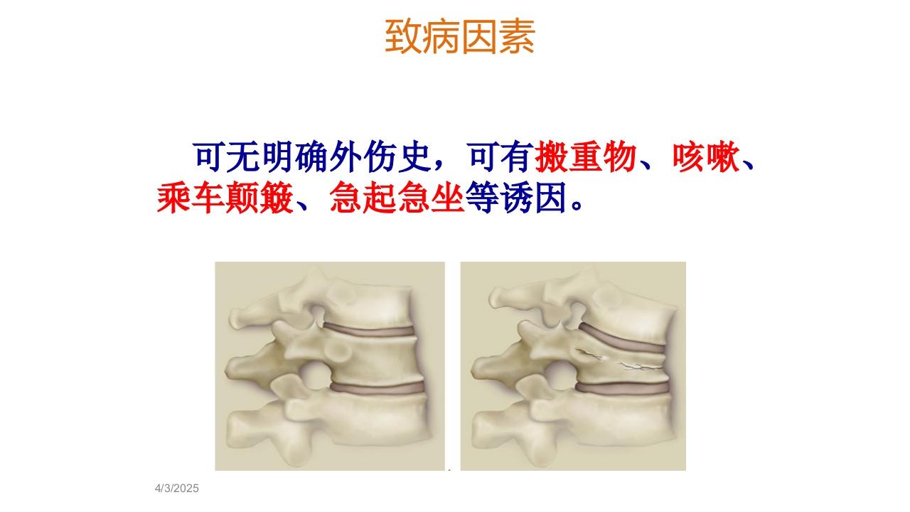 骨质疏松的诊断与治疗ppt课件20
