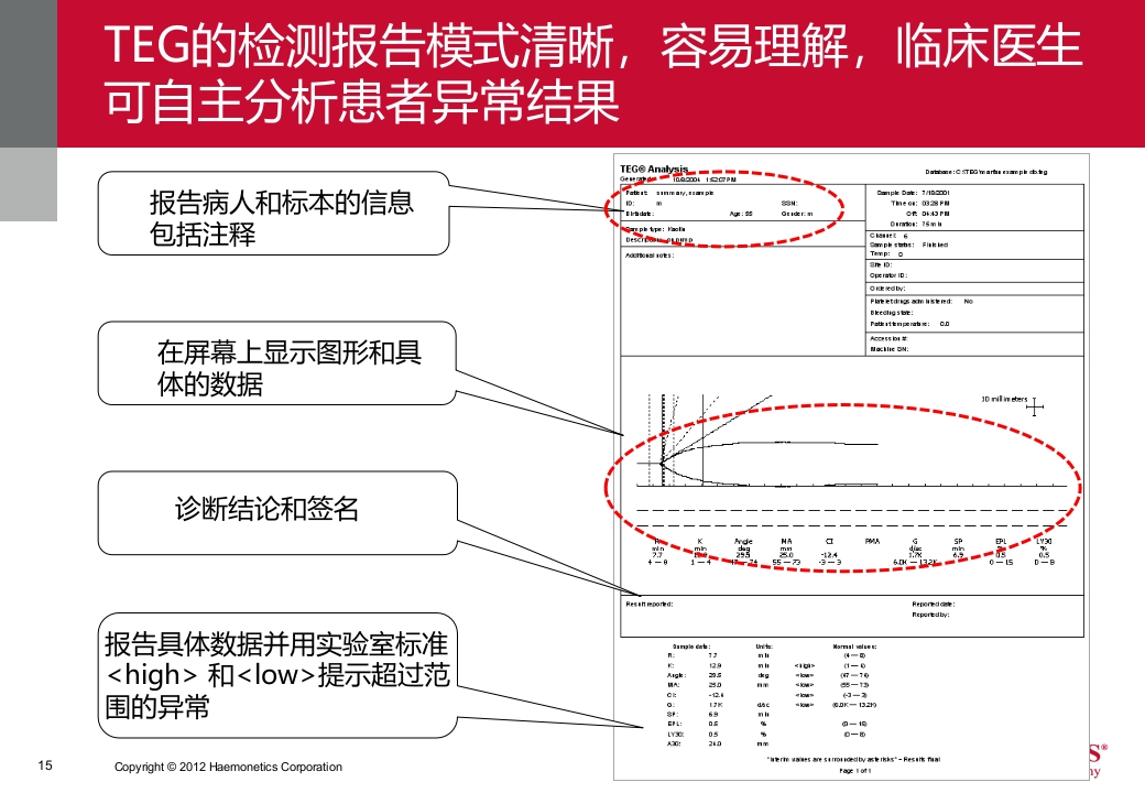 血栓弹力图临床应用PPT课件15