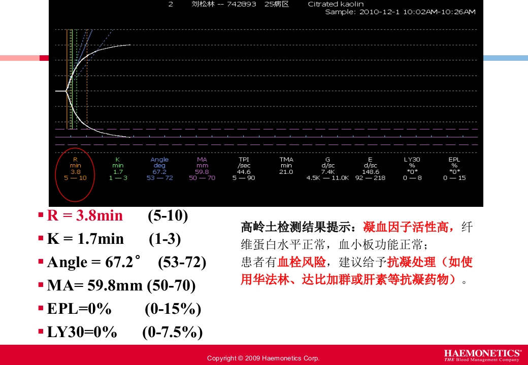 血栓弹力图临床应用PPT课件17