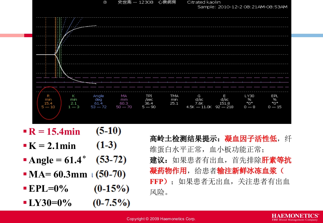血栓弹力图临床应用PPT课件18