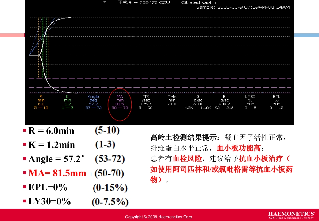 血栓弹力图临床应用PPT课件19