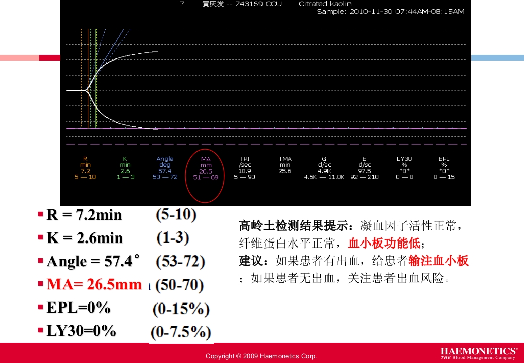 血栓弹力图临床应用PPT课件20