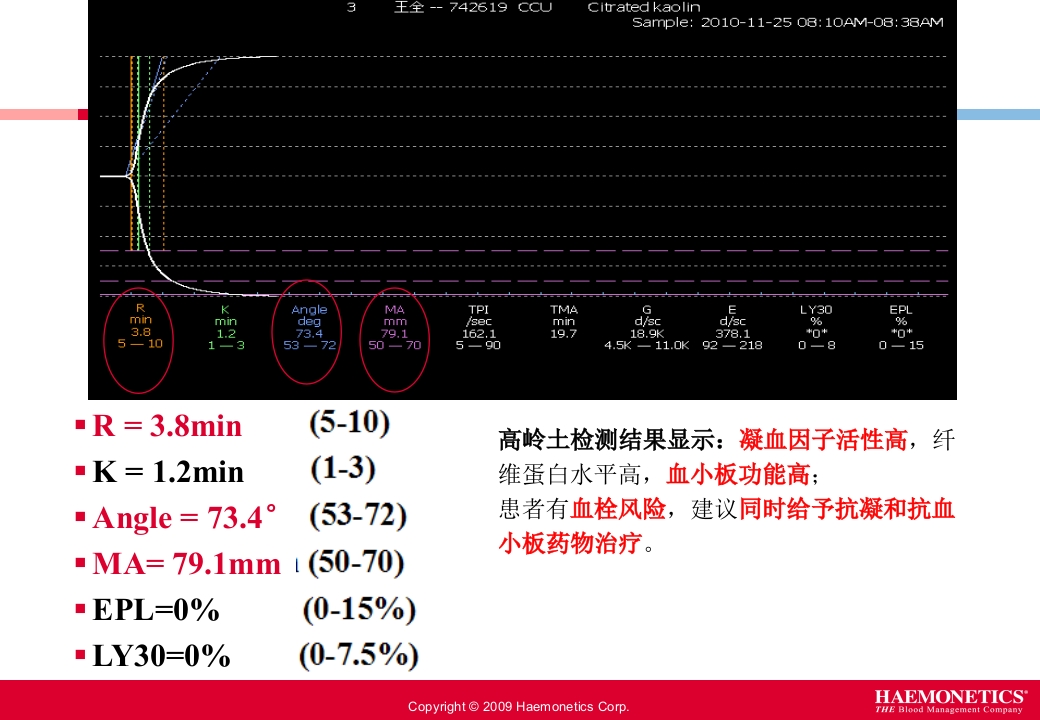 血栓弹力图临床应用PPT课件21