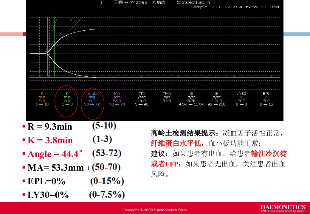 血栓弹力图临床应用PPT课件22