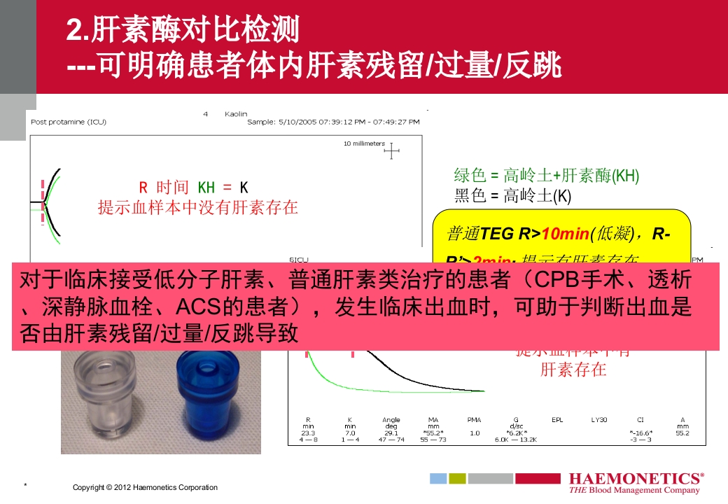 血栓弹力图临床应用PPT课件31
