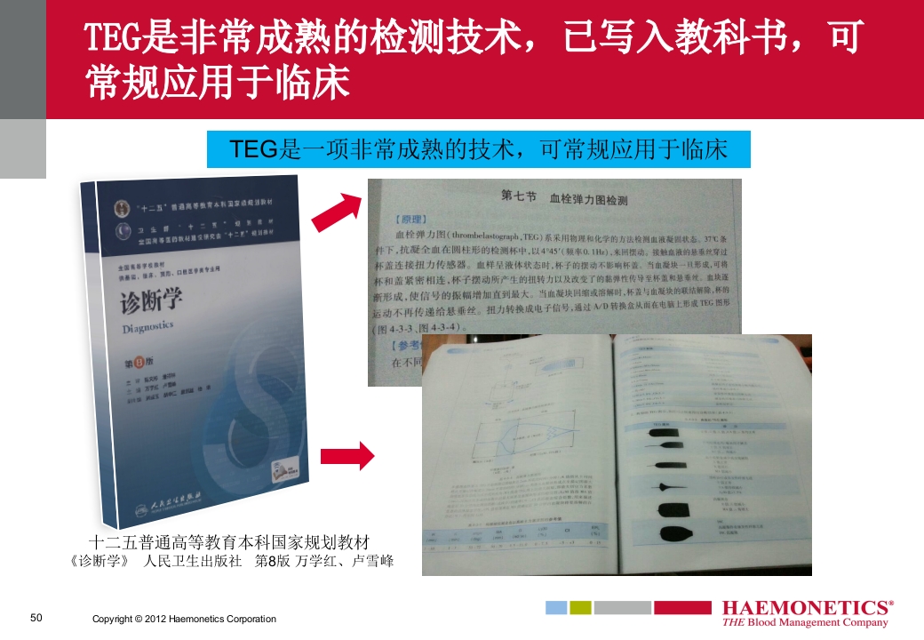 血栓弹力图临床应用PPT课件50