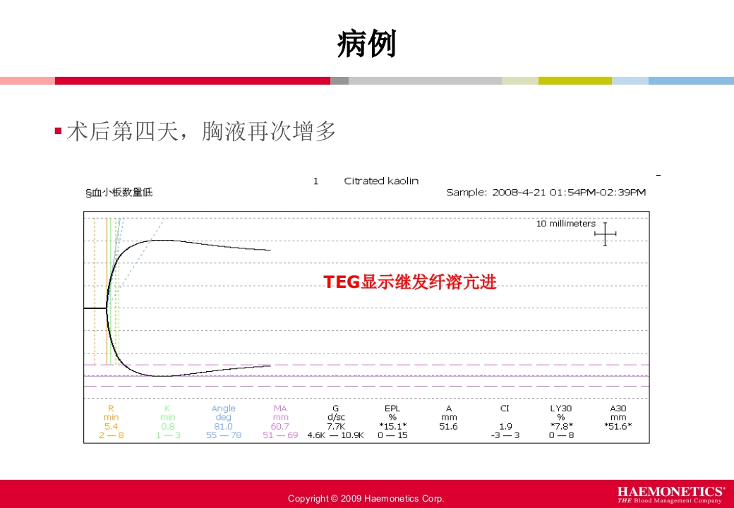 血栓弹力图临床应用PPT课件64