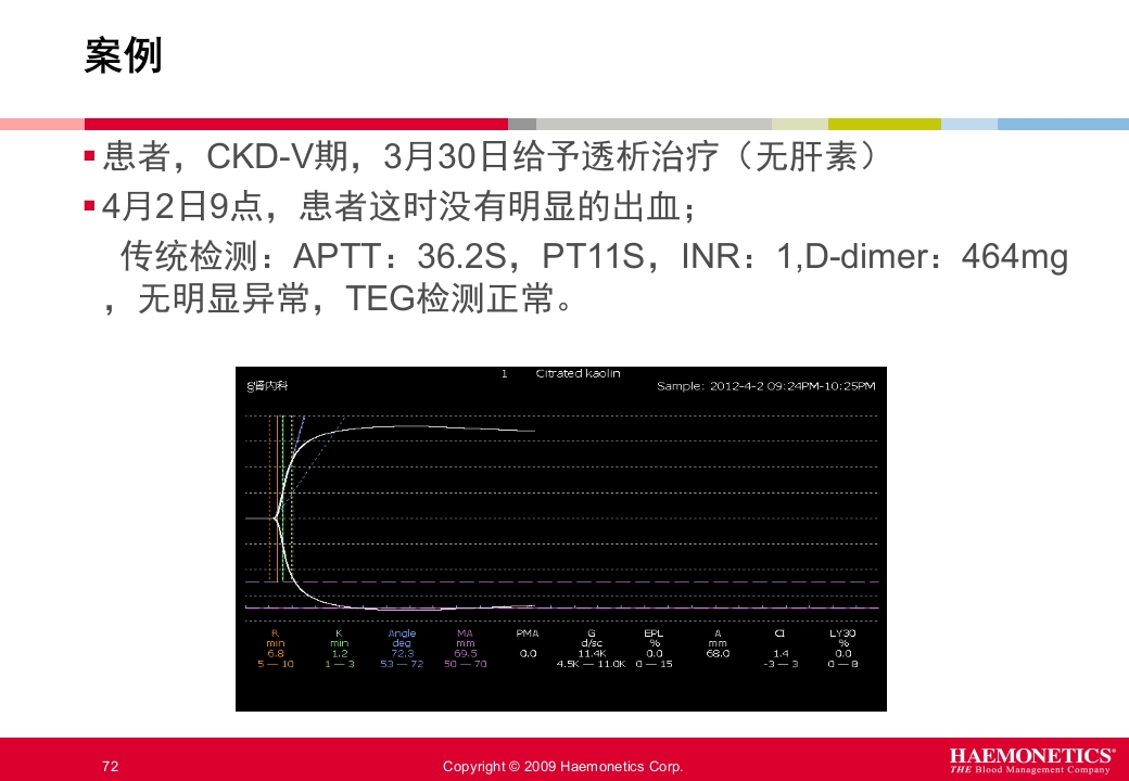 血栓弹力图临床应用PPT课件72