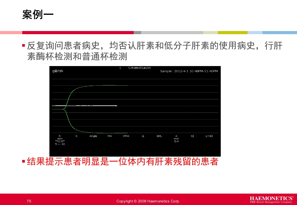 血栓弹力图临床应用PPT课件75