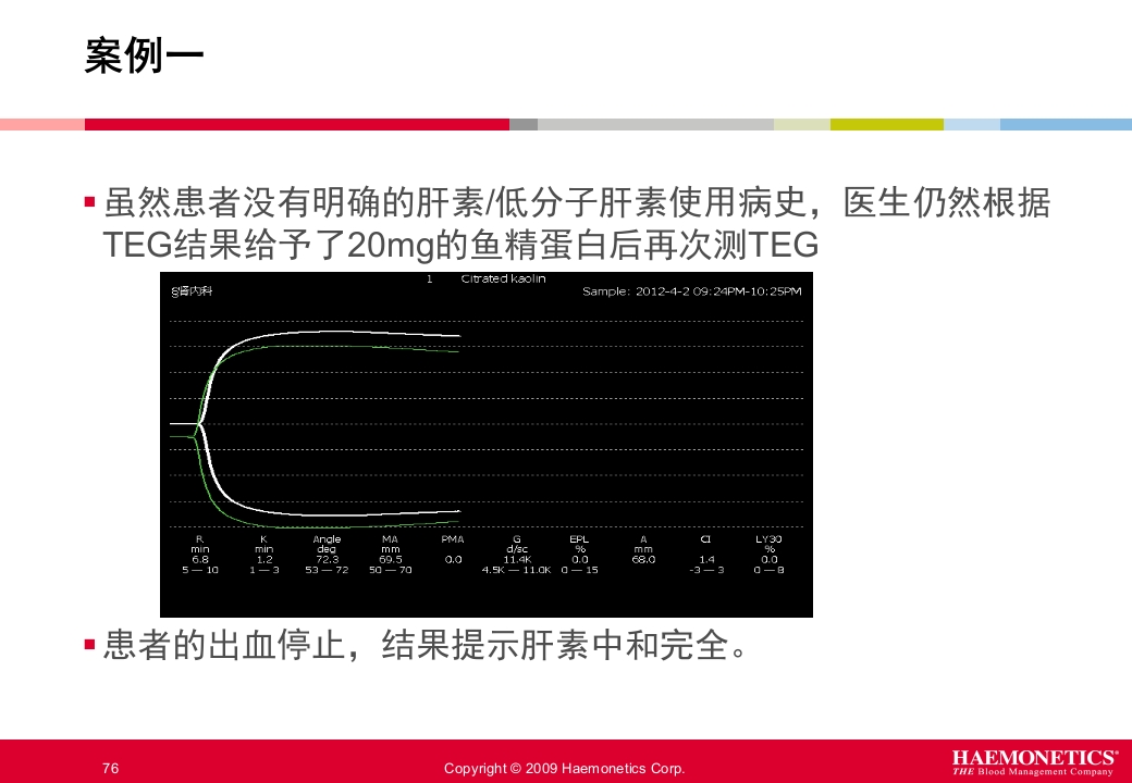 血栓弹力图临床应用PPT课件76