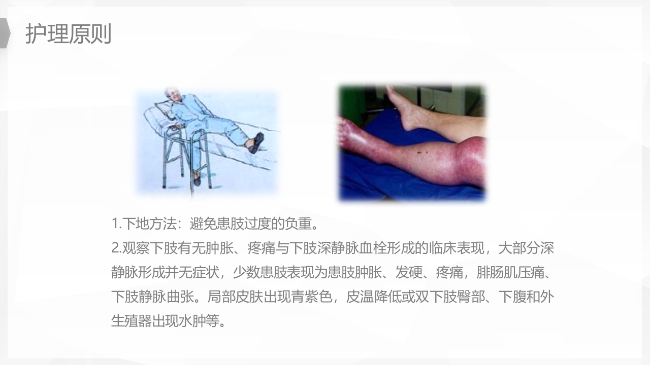 人工髋关节置换后预防下肢深静脉血栓的护理PPT课件17