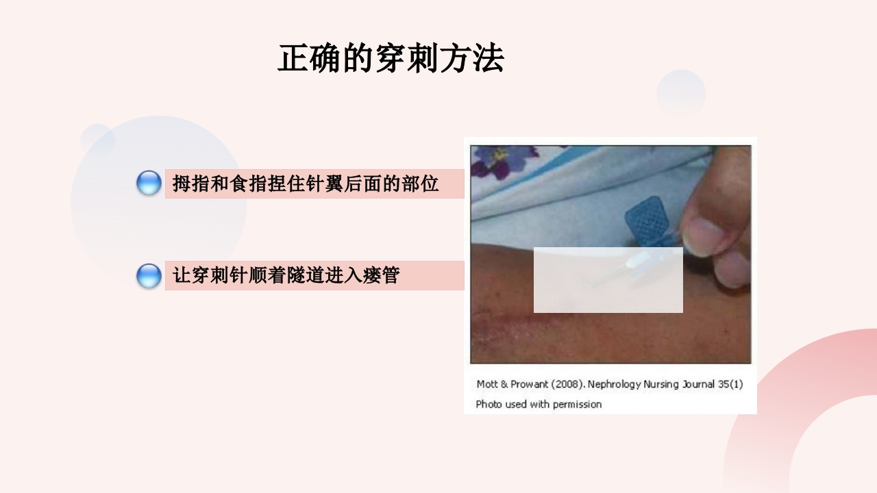 钝针穿刺法临床应用护理PPT课件13