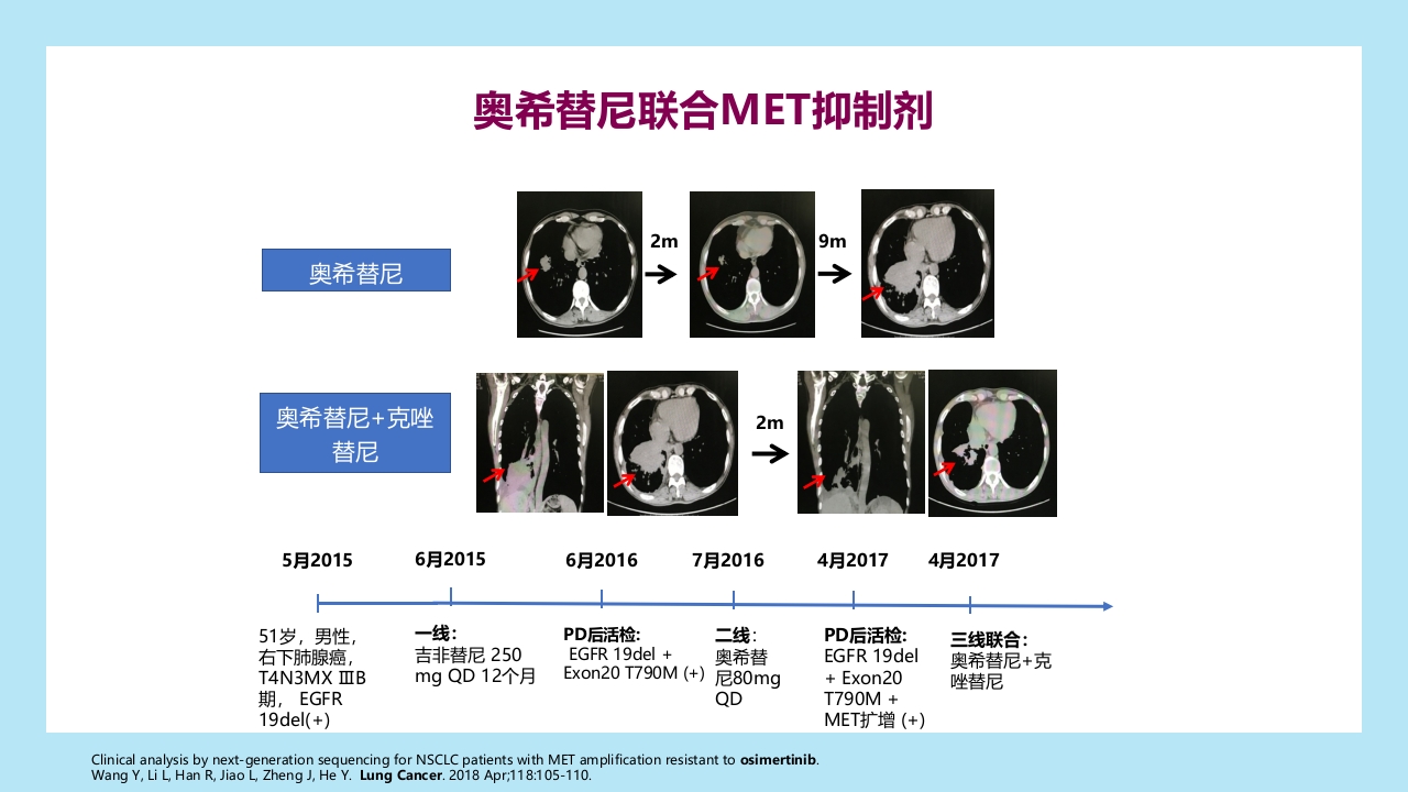 精准之路：EGFR突变NSCLC患者靶向治疗全程管理PPT课件38