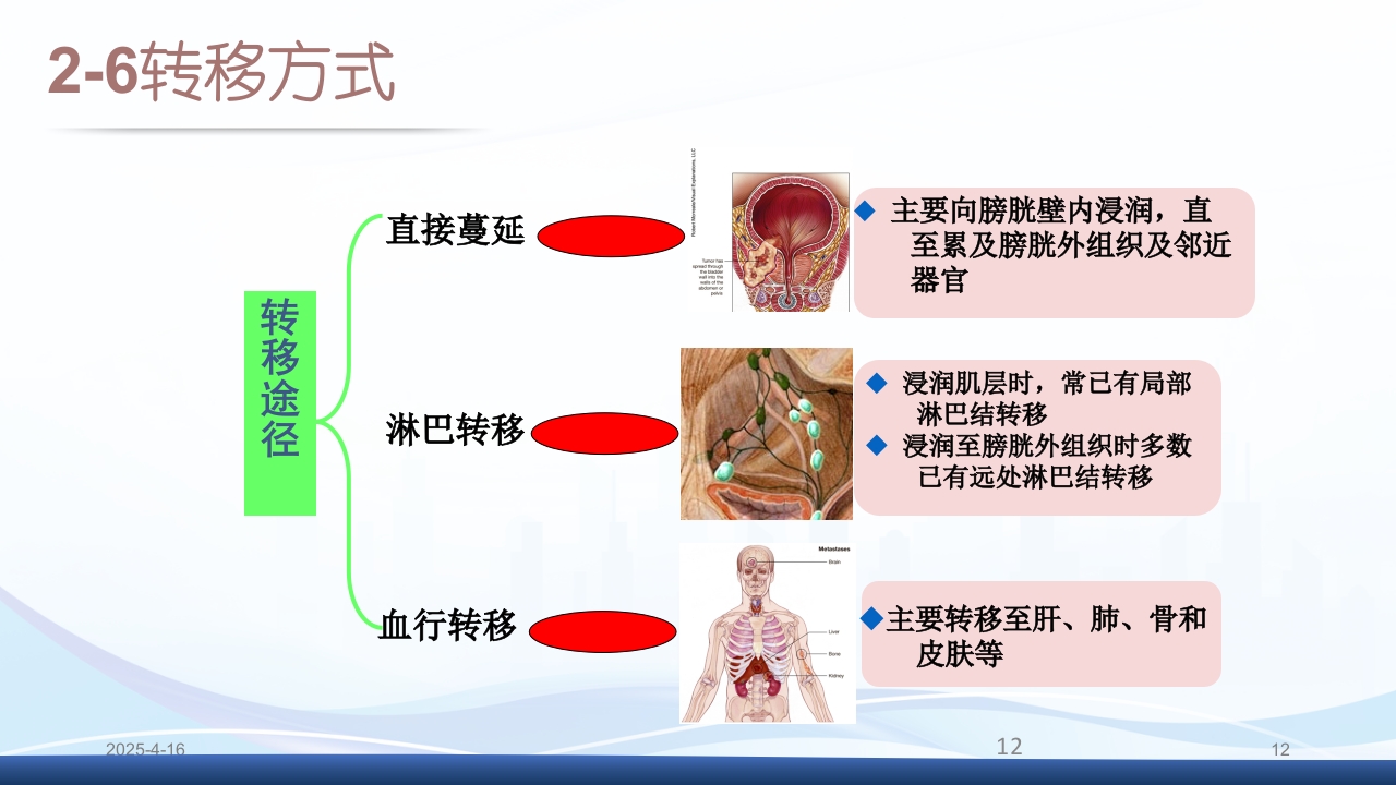 膀胱全切+回肠膀胱造口围手术期的护理查房PPT课件12