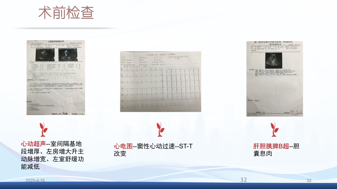 膀胱全切+回肠膀胱造口围手术期的护理查房PPT课件32