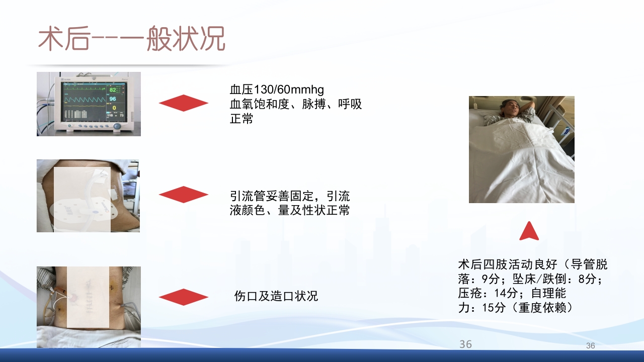 膀胱全切+回肠膀胱造口围手术期的护理查房PPT课件36