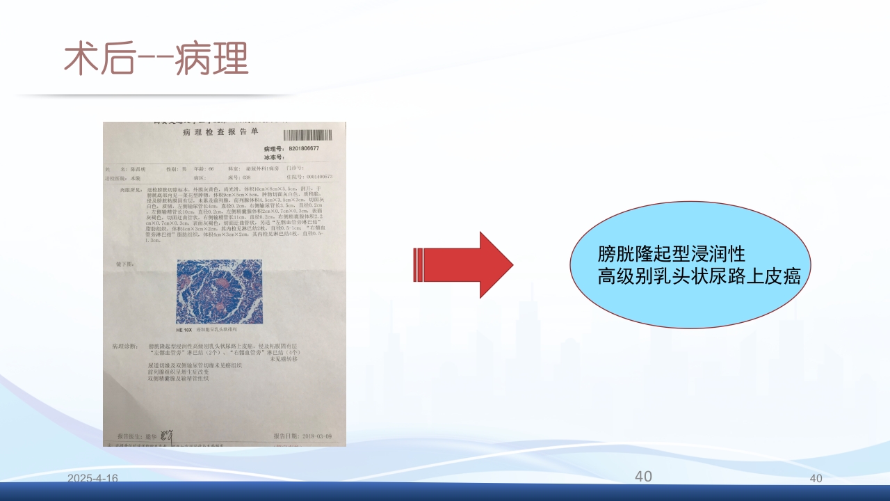 膀胱全切+回肠膀胱造口围手术期的护理查房PPT课件40