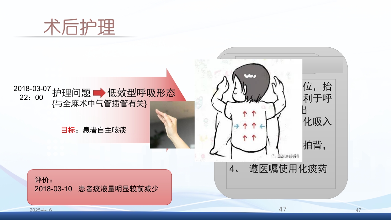 膀胱全切+回肠膀胱造口围手术期的护理查房PPT课件47