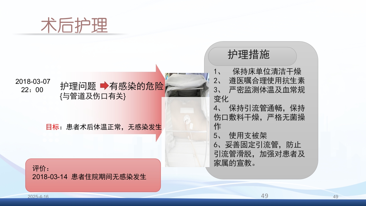 膀胱全切+回肠膀胱造口围手术期的护理查房PPT课件49