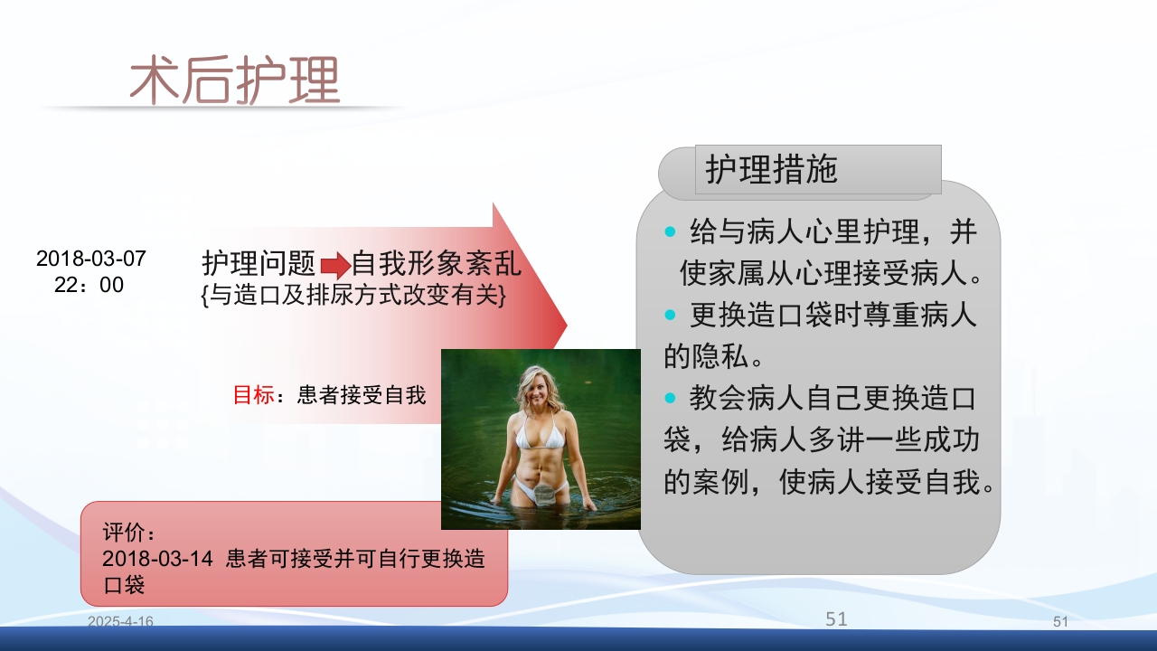 膀胱全切+回肠膀胱造口围手术期的护理查房PPT课件51