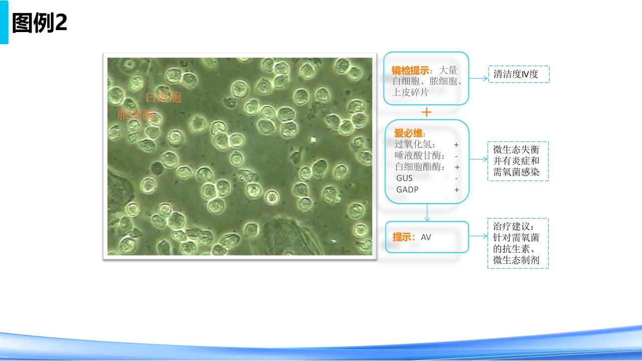 女性下生殖道感染疾病的诊断方法PPT课件51