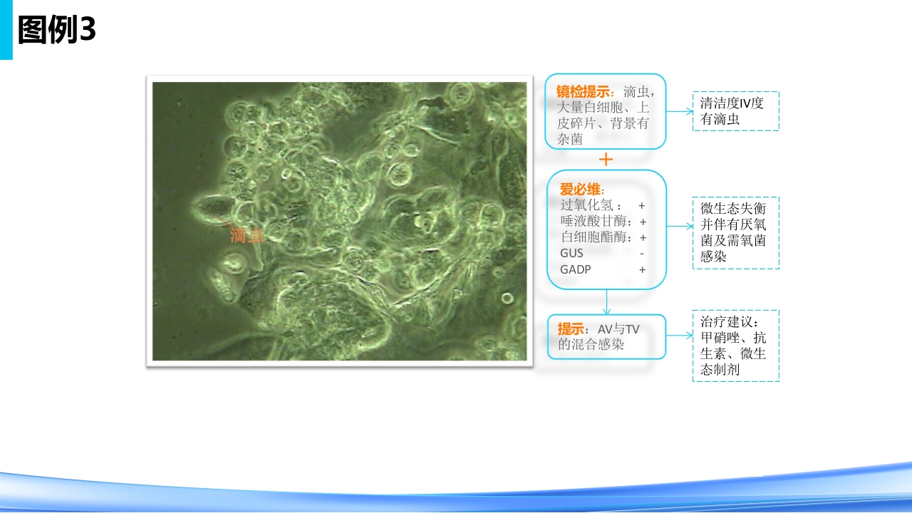 女性下生殖道感染疾病的诊断方法PPT课件52
