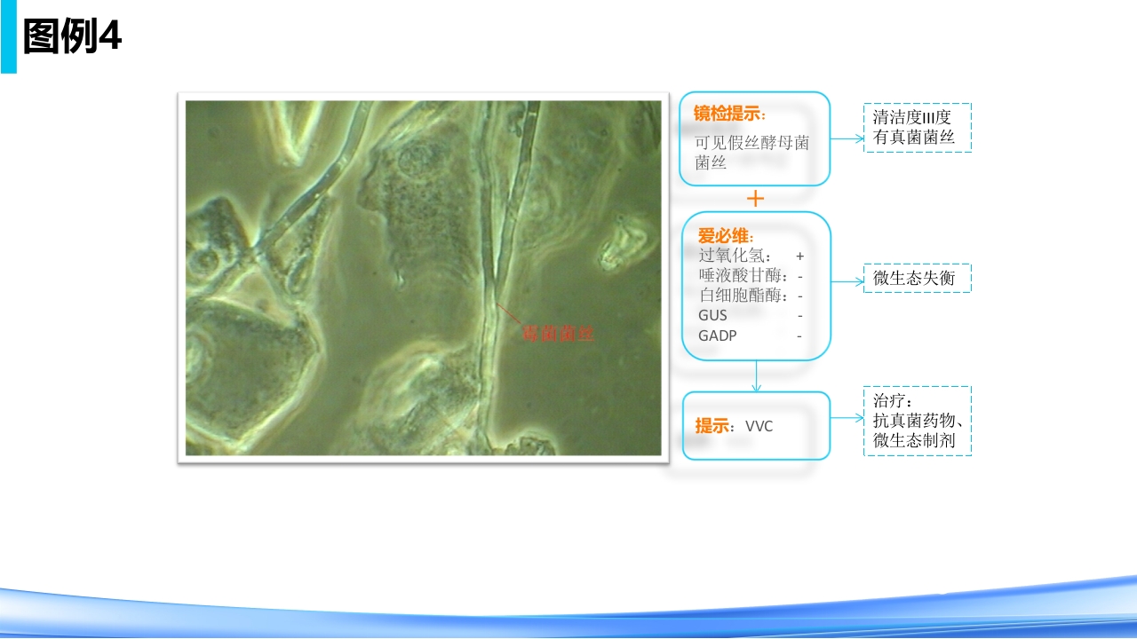 女性下生殖道感染疾病的诊断方法PPT课件53