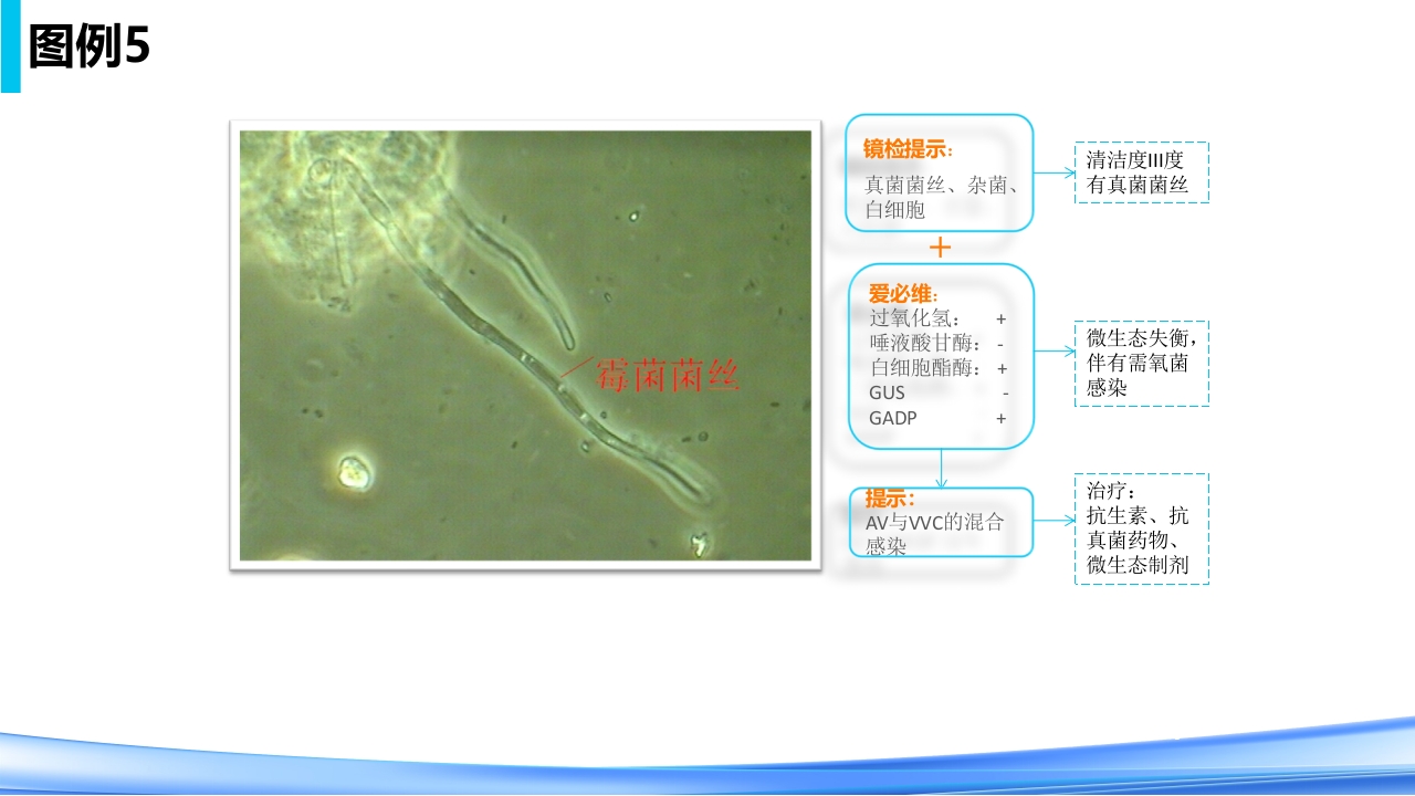 女性下生殖道感染疾病的诊断方法PPT课件54