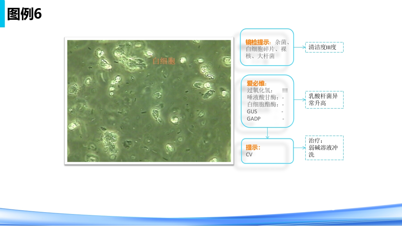 女性下生殖道感染疾病的诊断方法PPT课件55