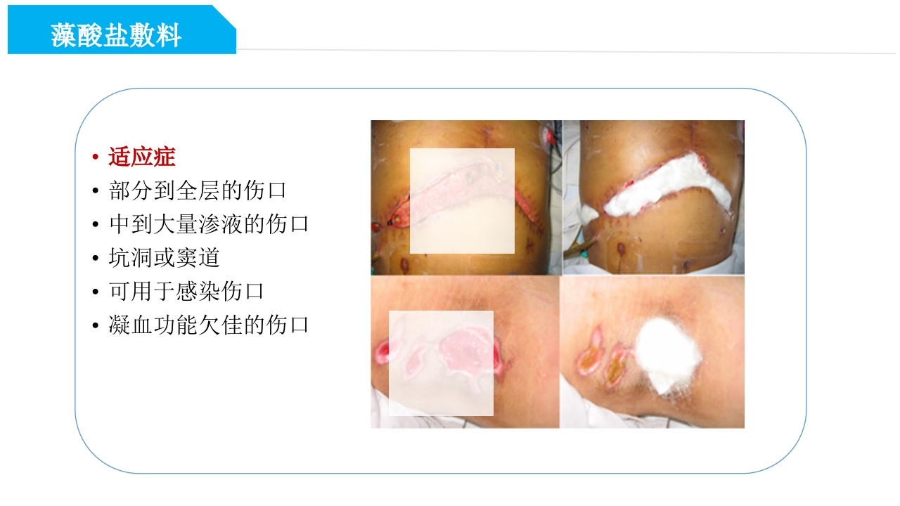 药物外渗和渗出的预防和处理PPT课件36