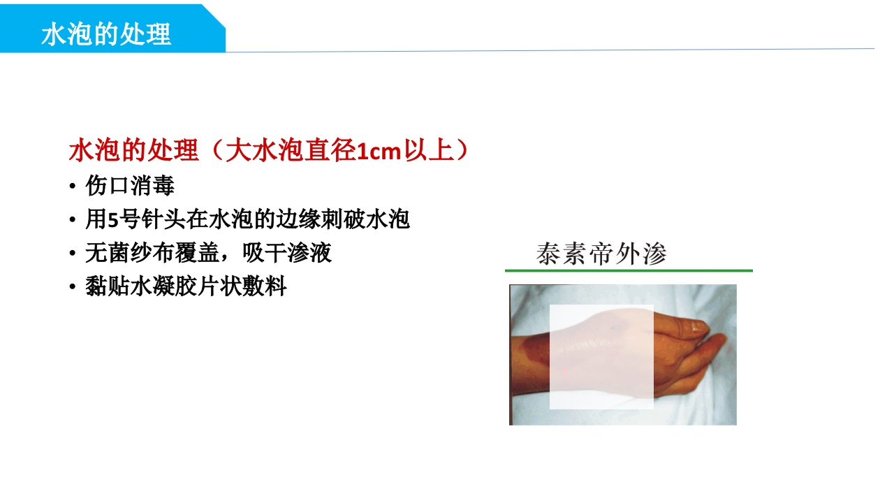 药物外渗和渗出的预防和处理PPT课件48