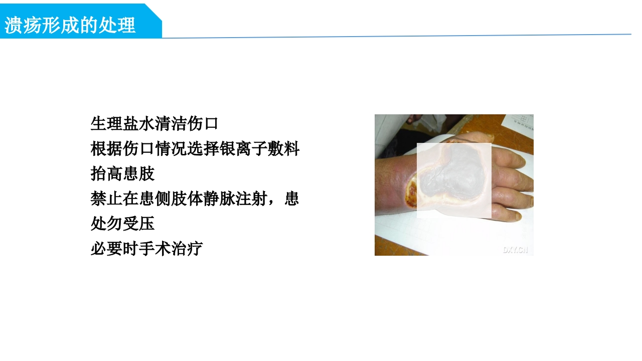 药物外渗和渗出的预防和处理PPT课件49