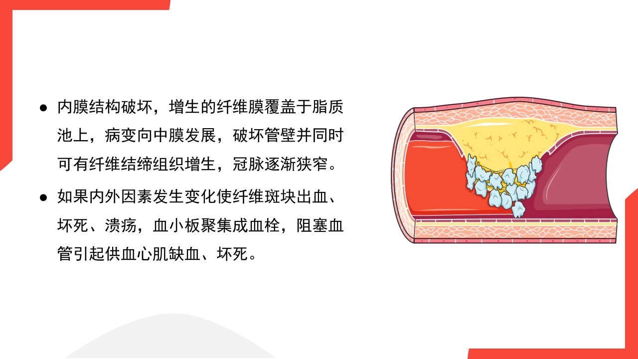 老年心血管疾病介绍PPT课件13