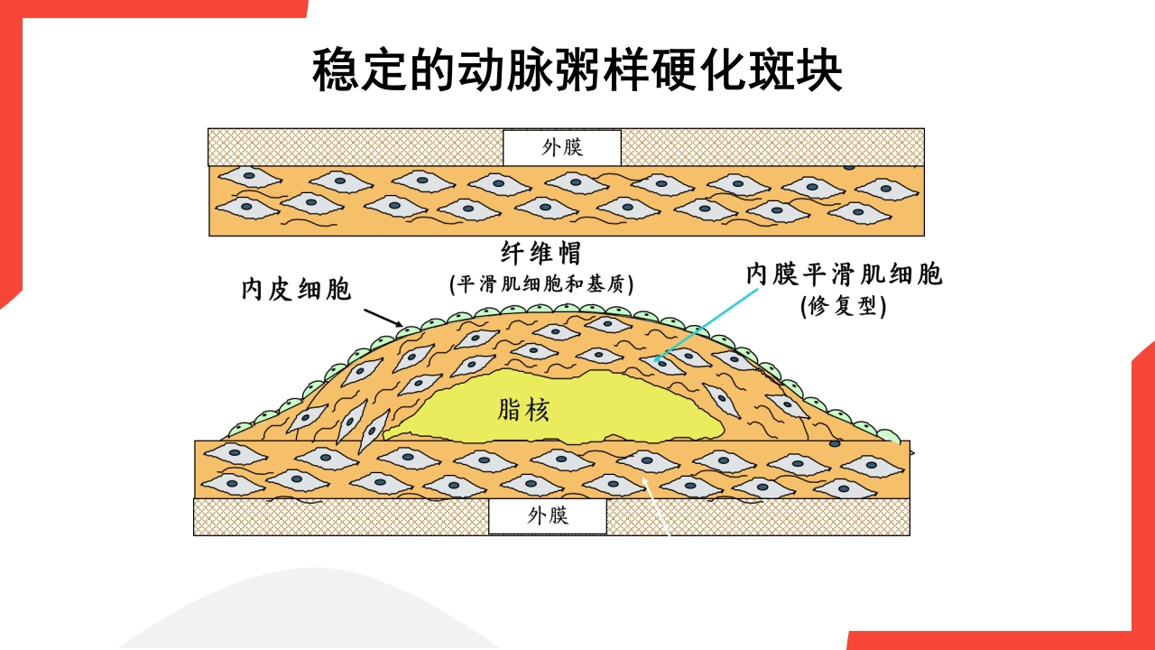 老年心血管疾病介绍PPT课件14