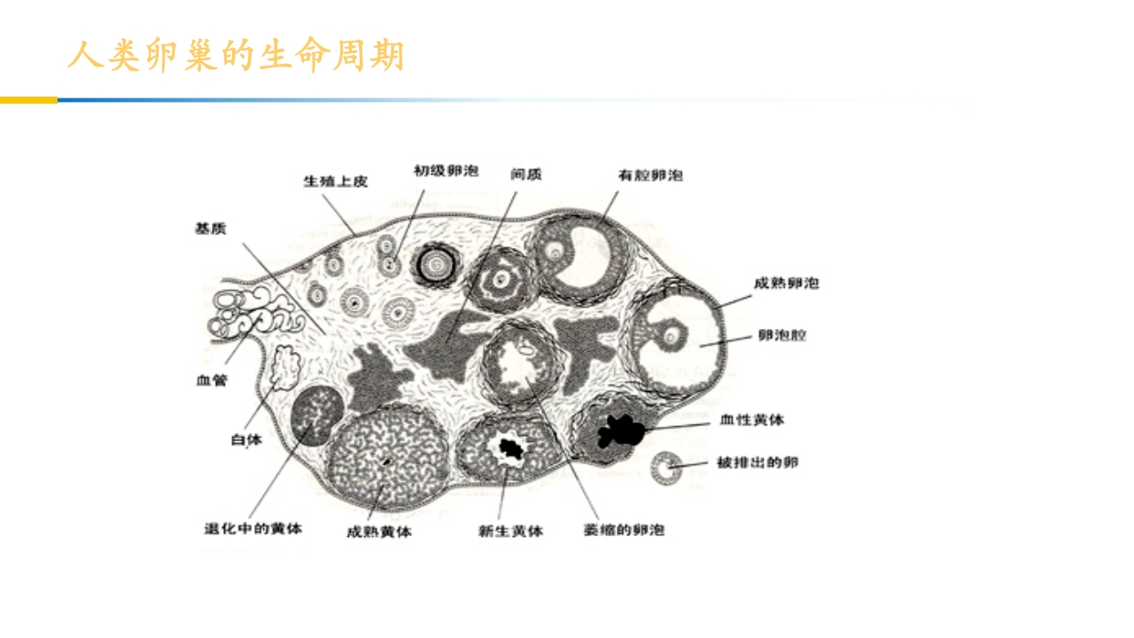 卵巢黄体破裂出血护理查房PPT课件3