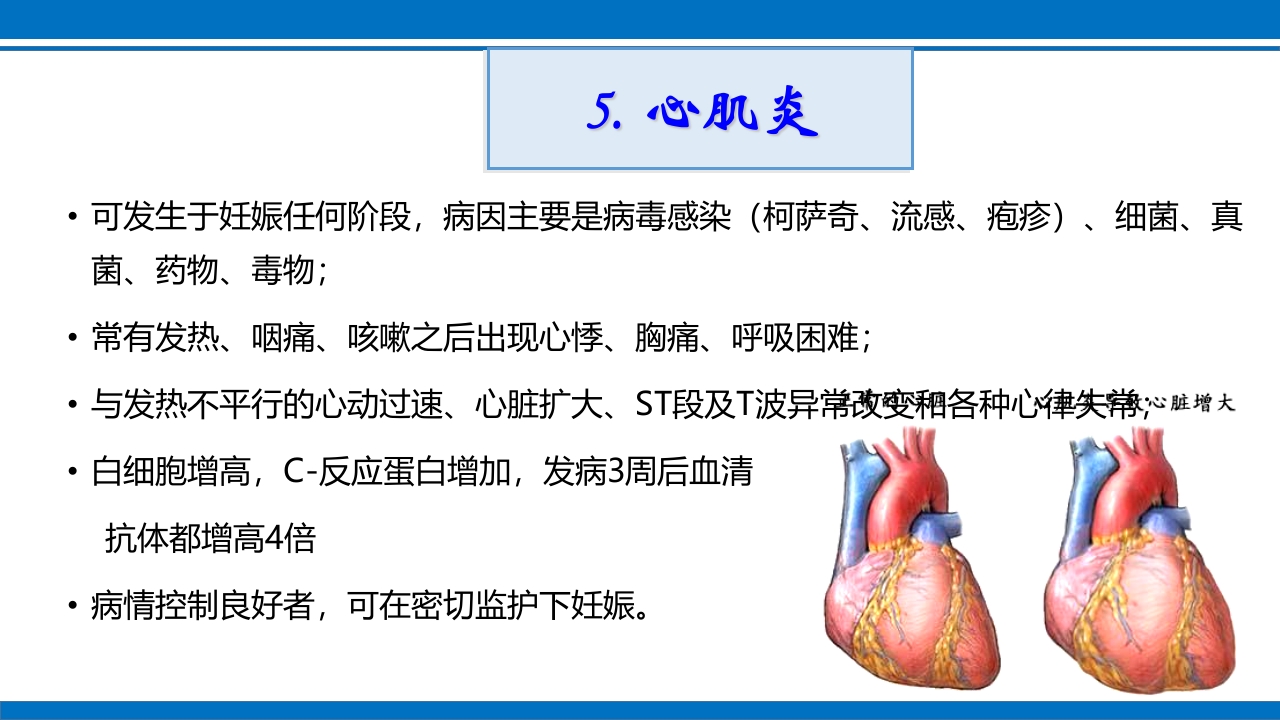 妊娠合并心脏病ppt课件11