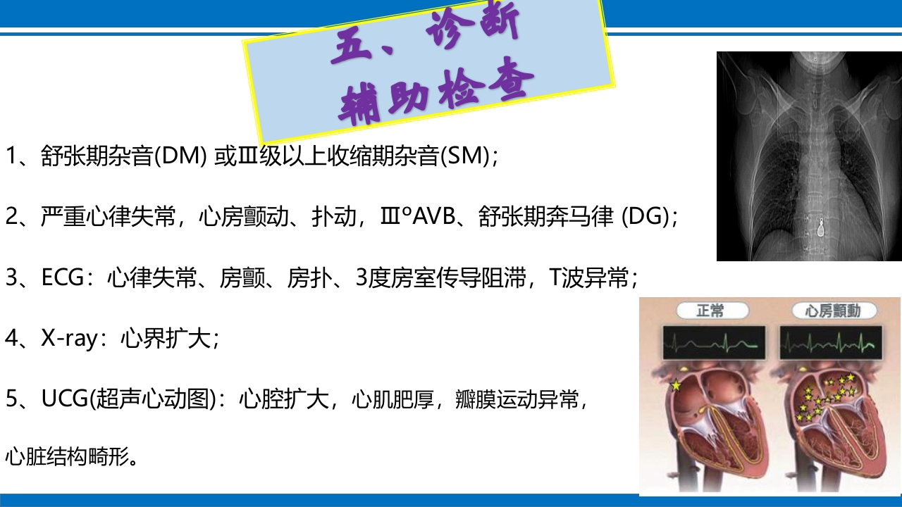 妊娠合并心脏病ppt课件18